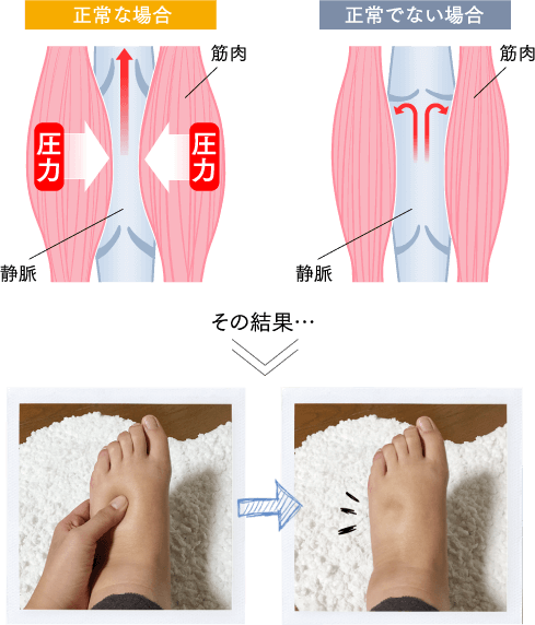 正常な場合と正常でない場合の比較